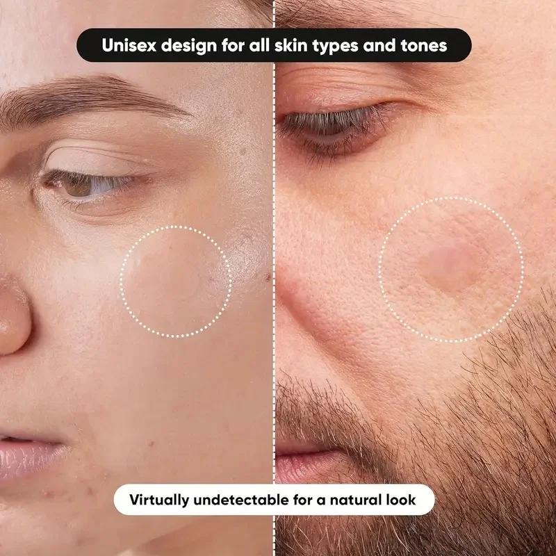 360 adet/kutu akne bantları -  - Face Oil incelemesi ve fiyatı