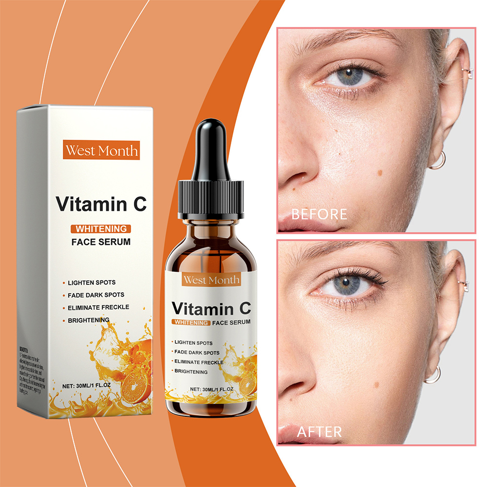 30ml West Month C Vitamini Ser - Vitamin C Serum incelemesi ve fiyatı